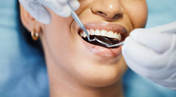 Best Urgent Dental Care in Mount Vernon, IA